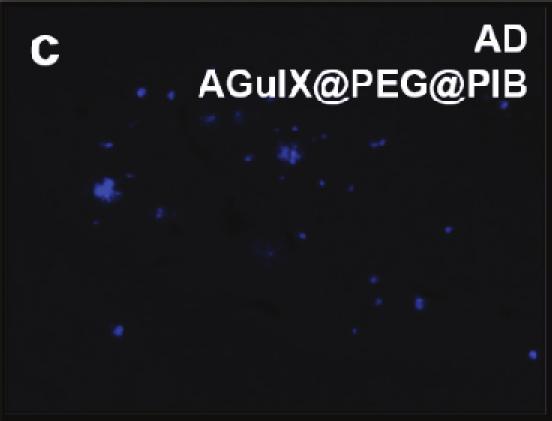 merging PIB and ThS fluorescent staining (A, F & H, white arrows).