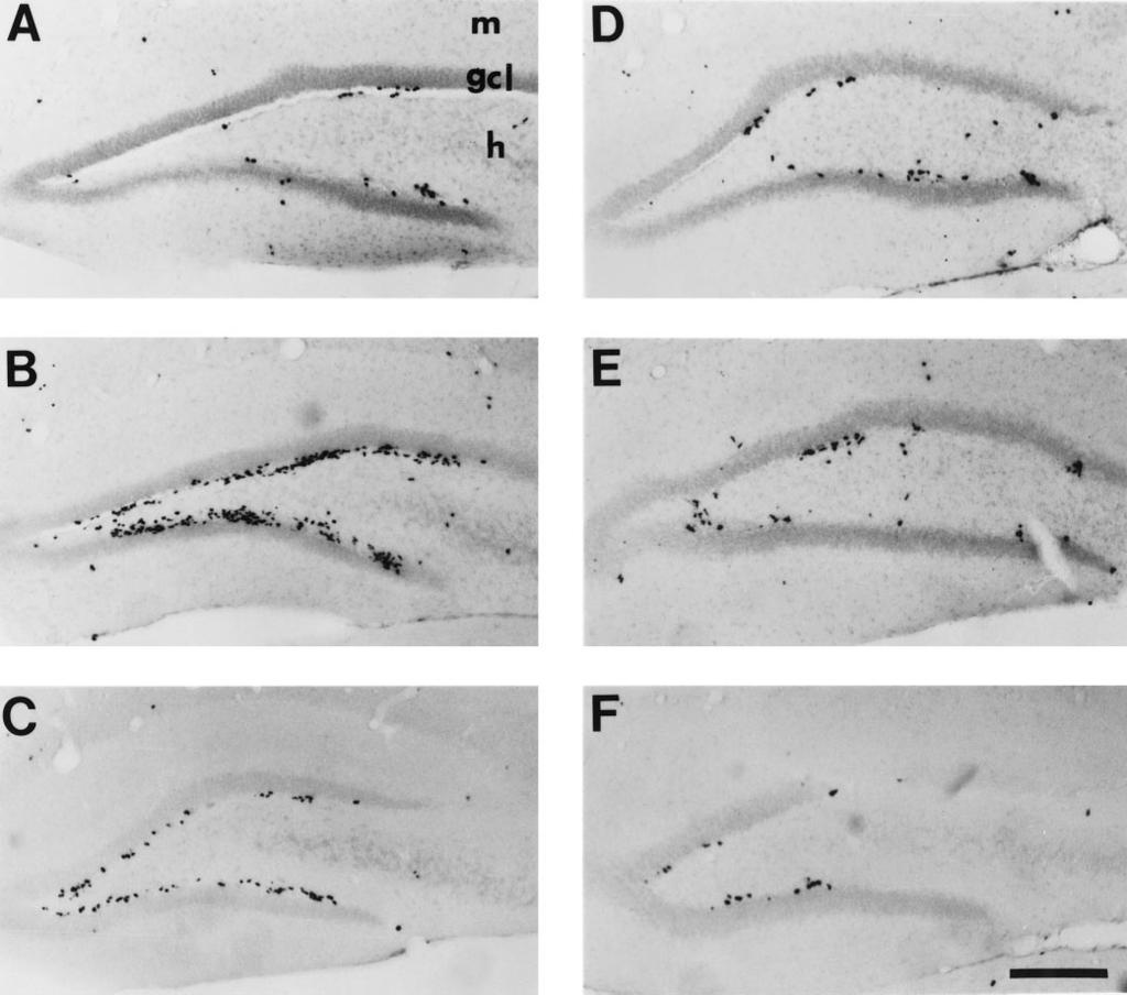 7770 J. Neurosci., October 1, 1998, 18(19):7768 7778 Liu et al. Dentate Gyrus Neurogenesis Increases after Ischemia Figure 1.