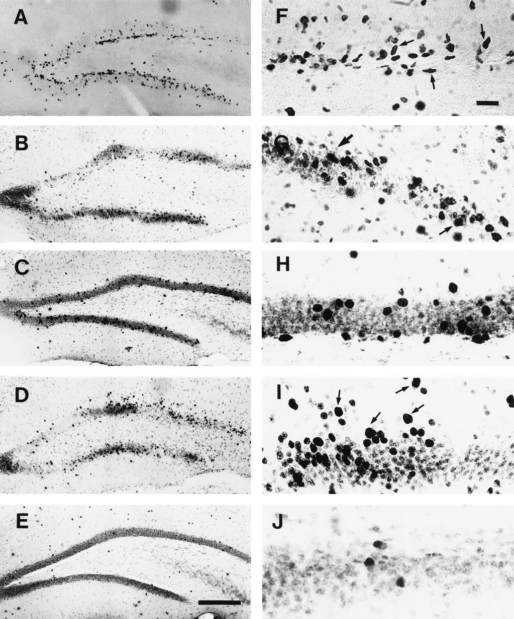Liu et al. Dentate Gyrus Neurogenesis Increases after Ischemia J. Neurosci., October 1, 1998, 18(19):7768 7778 7773 Figure 4. Distribution and morphology of BrdU-labeled cells after global ischemia.