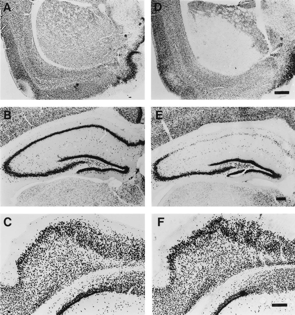 7774 J. Neurosci., October 1, 1998, 18(19):7768 7778 Liu et al. Dentate Gyrus Neurogenesis Increases after Ischemia Figure 5.