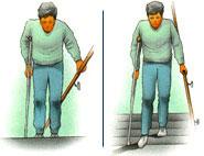 Stair Climbing and Descending The ability to go up and down stairs requires both flexibility and strength.