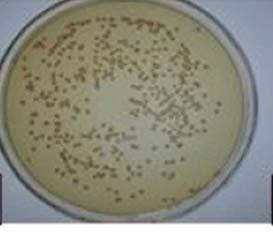 25 mls were spread on the plate and 20 colonies counted. Total colonies = 4 x 20 or 80 CFUs/ml C) 10 µl (0.