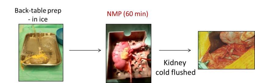 End-ischaemic NMP - clinical Courtesy S. Hosgood 18 ECD kidneys NMP vs.