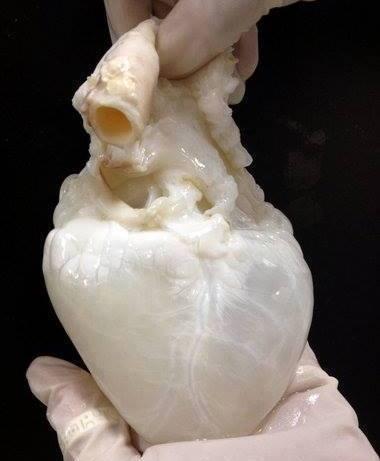 Decellularised human heart