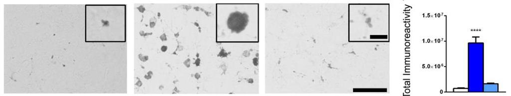 AAV9-CLN6 Gene Therapy for CLN6-Batten Disease 50 CLN6: Preclinical Mouse Data Somatosensory