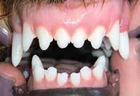 DENTAL CONDITIONS ARE PAINFUL Almost every condition listed within is painful to the pet. BABY TEETH PROBLEMS Baby teeth naturally are shed as the adult teeth erupt.