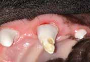 EXTRACTIONS Any time a tooth is damaged, we need to remove that painful tooth or preserve the tooth by another method (such as root canal therapy).