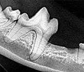 All sites of missing teeth need to be verified by intraoral x-rays to see if truly missing.