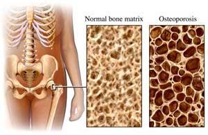GSE with calcium has a beneficial effect on bone formation and bone strength.