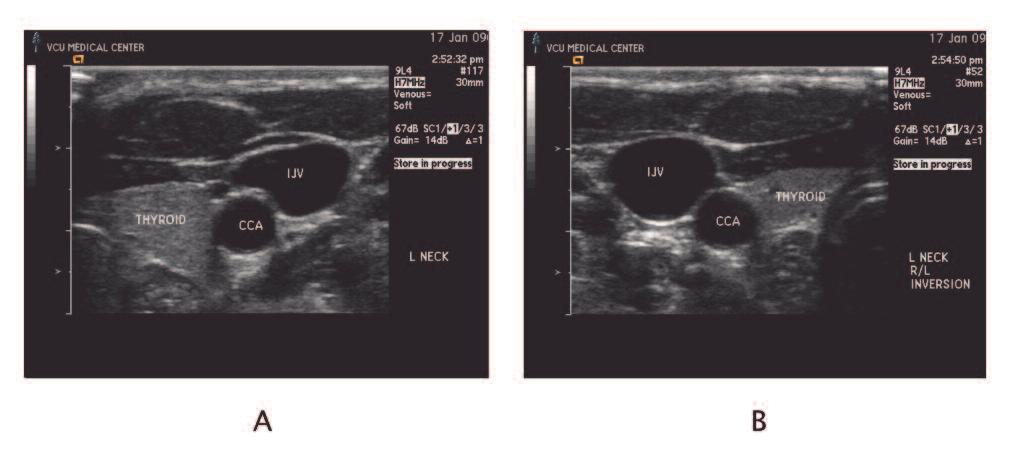 Figure 9. How to Ensure an Accurate Ultrasound Image Proper transducer orientation is the first step to accurately interpreting an ultrasound image.