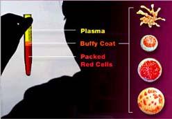 Blood Component Separation Platelets Buffy coat Lymphocytes