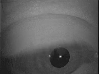 artifact looks identical to saccadic nystagmus!