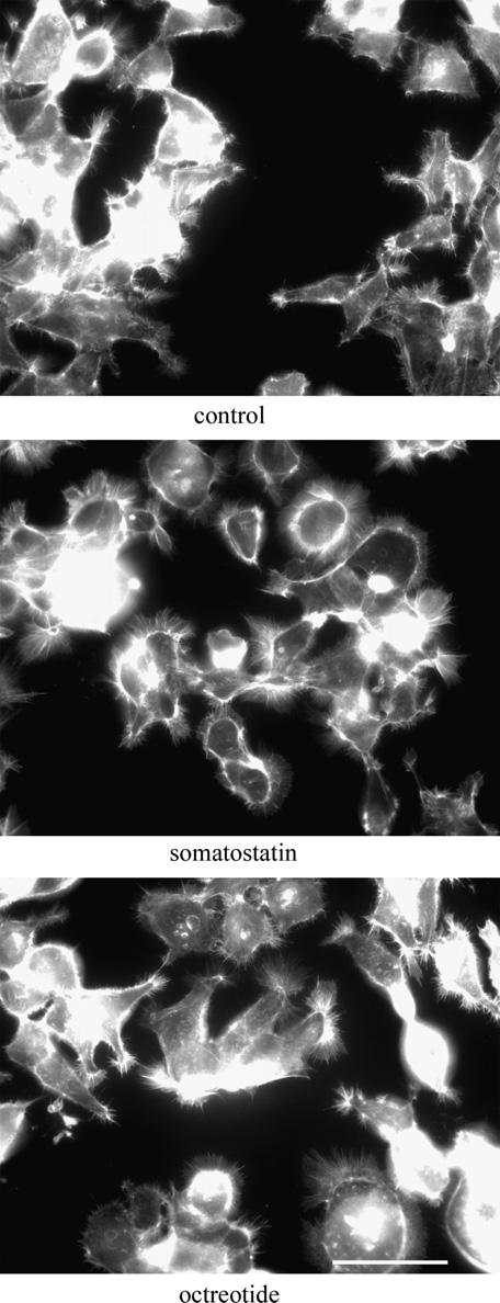 J. Saras et al. / FEBS Letters 581 (2007) 1957 1962 1959 Five minutes stimulation with 500 nm somatostatin induced numerous thin filopodia-like protrusions in a majority of the cells (Fig.