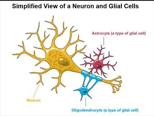 (infiltrative) vs Discrete gliomas