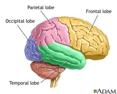 Progressive neurologic deficit Frontal lobe Personality changes Parietal lobe weakness or loss of sensation Temporal lobe language problem (Aphasia) Occipital lobe visual field