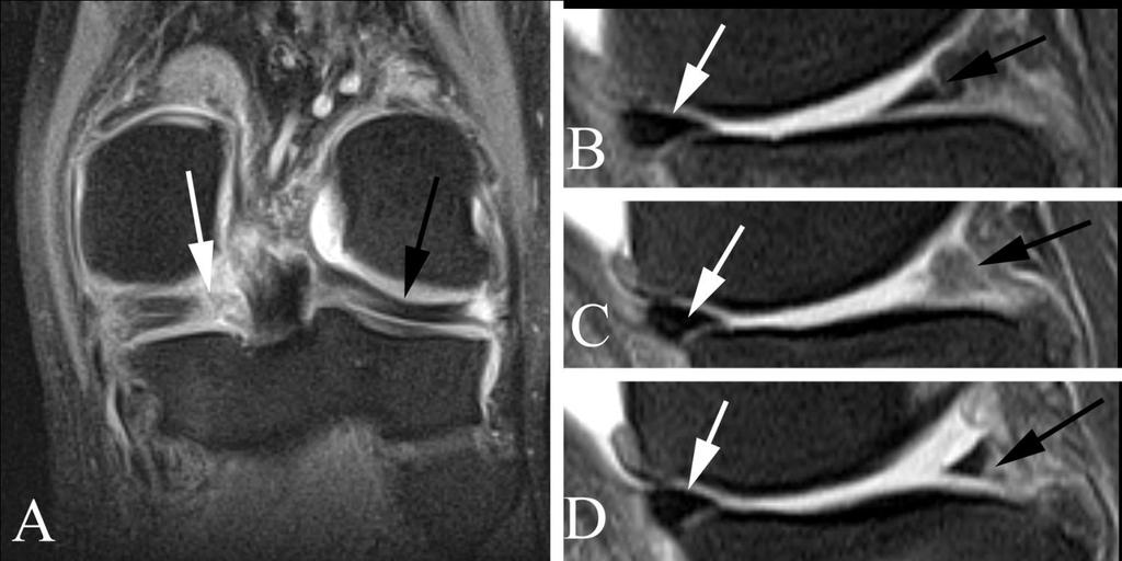 12/01/2012 Radiology Quiz of the Week #101 Page 4 IMAGING STUDY QUESTIONS AND ANSWER Imaging questions: 1) What type of study is shown? A knee magnetic resonance (MR) imaging study.