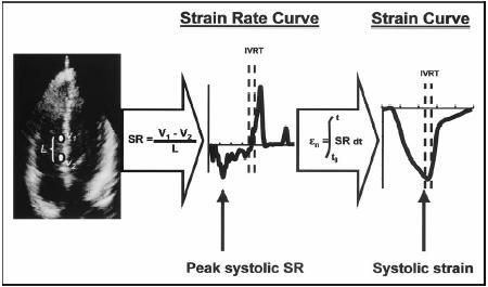Strain Rate vs