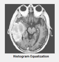 The focus of this study is to develop an automatic region growing algorithm that can accurately segment primary brain tumors in MR Images.