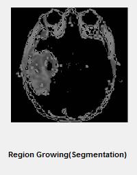 Superimposed of color and gray image Region Growing The seed feature point is considered, while segmenting the region in an image.