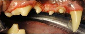 Cyclosporine If gingival hyperplasia develops Try reducing dose Azithromycin oral