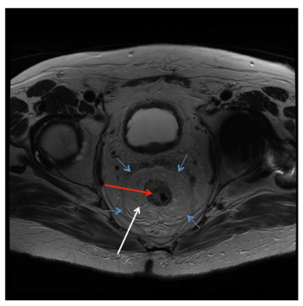 Fig. 2: Anatomy on MRI axial image.