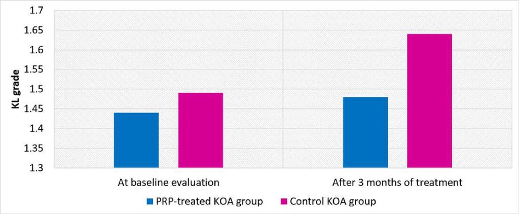 Fig.4. The frequency of KL-grade between the PRP-treated group and control group at baseline and after 3 months of treatment (P= 0.048) Table1(Patient Screening Criteria) Inclusion Criteria 1.