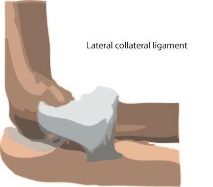 treated. Anatomy of the Elbow The elbow is a hinged joint made up of three bones, the humerus, ulna, and radius.