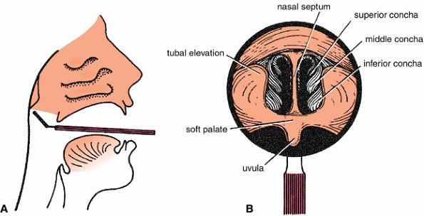 Examination of the Nasal Cavity It should be remembered that the nasal septum is rarely situated in