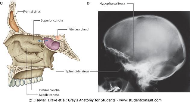 Sphenoidal Sinuses The two sphenoidal