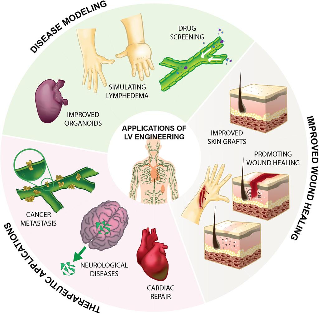Alderfer et al. Journal of Biological Engineering (2018) 12:32 Page 3 of 26 Fig. 1 Multiple areas of medicine and disease pathologies could benefit from advances in lymphatic tissue engineering.