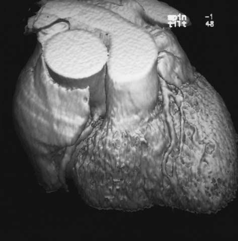 Panel B shows a reconstruction of the complete heart.