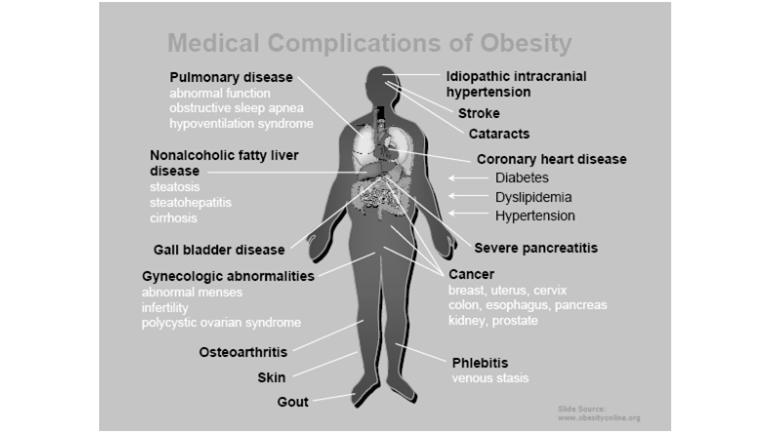 Impact of Obesity Comorbid Diseases Premature Death