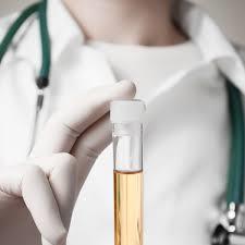 Assessment with toxicology testing Type of tests