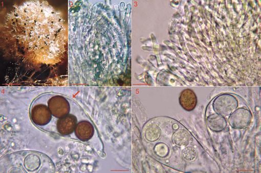 Figs 1 5 Ascobolus perforatus CLSM 006.11. 1 Ascoma on dung.
