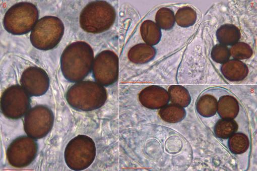 4 Ascus with only four mature ascospores. 5 Immature asci and one, free mature ascospore.