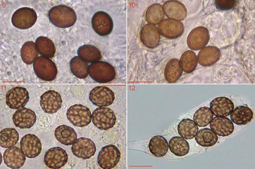 Figs 9 10 Ascobolus perforatus. CLSM 006.11. 9 Free mature ascospores. 10 Pitted ascospores inside asci.