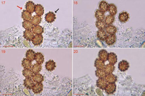 Figs 17 20 Ascodesmis microscopica. CLSM 02899.