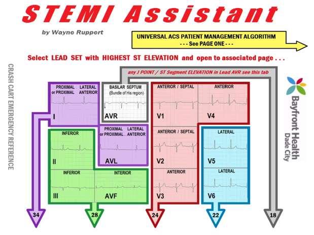 STEMI Assistant: an Emergency Crash Cart Interactive