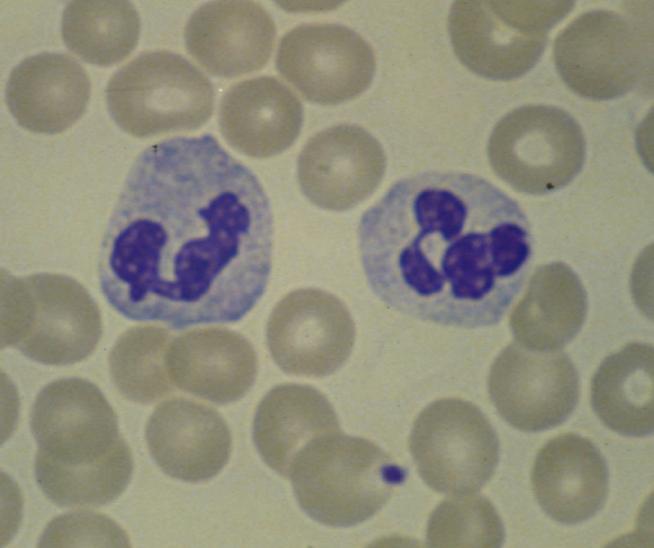 Neutrophils Nucleus is composed of several lobes connected by thin nuclear strands. Also called PMN (polymorphonuclear) neutrophils because of their nuclear shape.