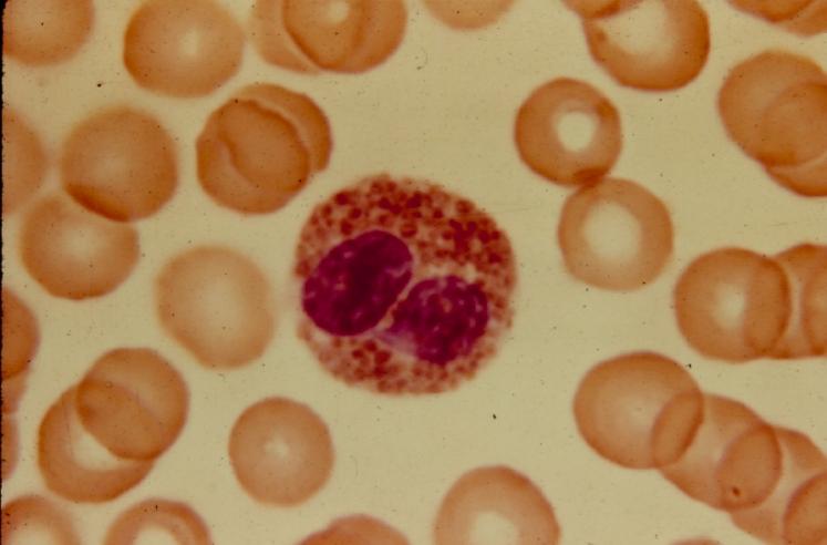 Eosinophils Acidophilic granules erythrocytes Typical bi-lobed nucleus. Eosinophils secrete histaminase which breaks down histamine and reduces inflammatory reactions.