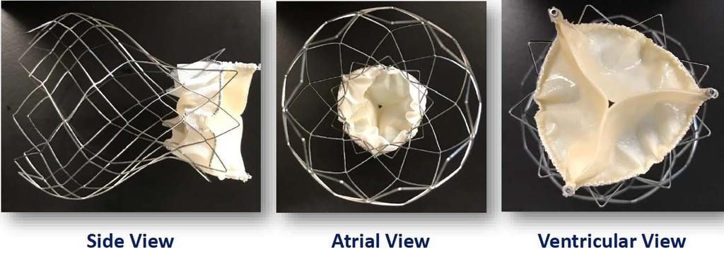 AValve Conformational atrial cage for securing