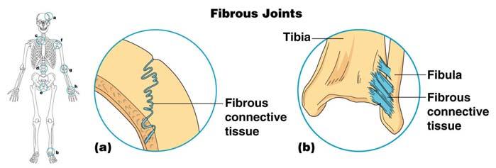 Fibrous Joints Bones united by fibrous tissue Example: Sutures Syndesmoses Allows more