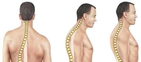 Skeletal Changes Throughout Life Curvatures of the spine Primary curvatures are