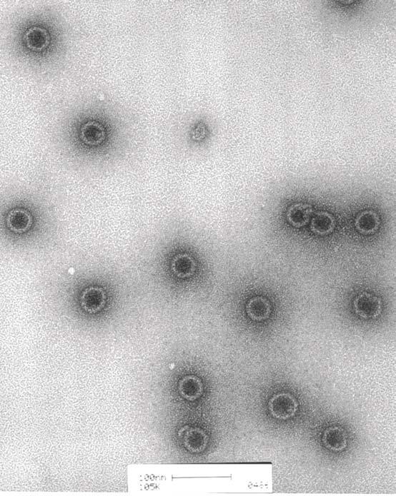 Electron Micrograph of Purified SV40 VLPs PREPARATION AND PURIFICATION of VLPs: SV40, BK, and JC VP1 expressed in insect cells from