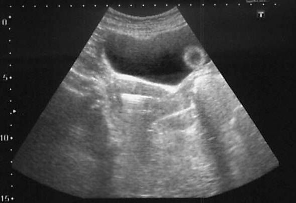 Ultrasound images are very useful