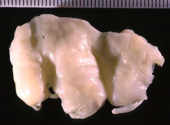 characteristic lesions
