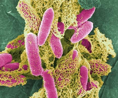 coli Bacteria can be killed with antibiotics because these substances