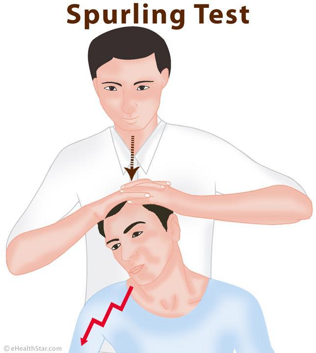 Spurlings Test High specificity 95%, mild to moderate sensitivity (Jones 2018) Patient seated.