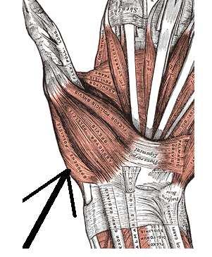 thumb 2. AbPB Origin: flexor retinaculum, scaphoid tubercle and trapezium Insertion: radial side of base proximal phalanx of thumb Action: abducts thumb 3.