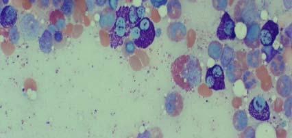 Increased mast cells (>20%), abnormal morphology in aspirate smears, no